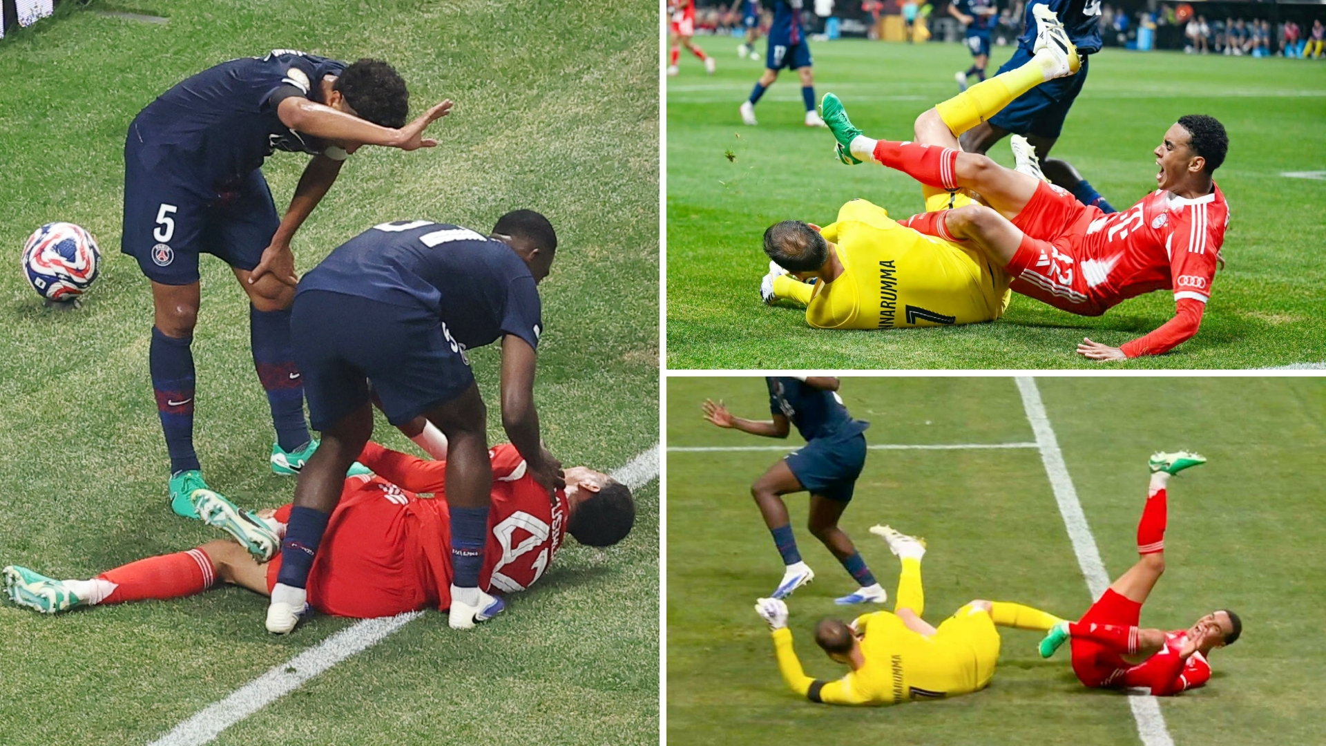 包含瓦伦西亚传奇:球星大腿受伤的词条 包含瓦伦西亚传奇:球星大腿受伤的词条